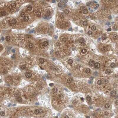 Immunohistochemistry-Paraffin: GALT Antibody [NBP1-86138] - Staining of human liver.