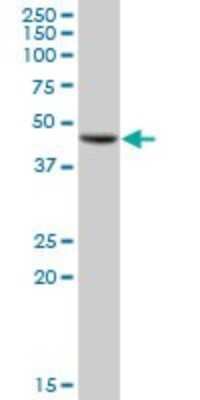 Western Blot: GALT Antibody [H00002592-B01P] - Analysis of GALT expression in human liver.