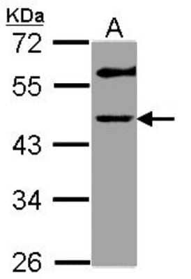 Western Blot: GALT Antibody [NBP1-33585] - Sample (30 ug of whole cell lysate) A: Hep G2 10% SDS PAGE; antibody diluted at 1:1000.