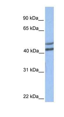 Western Blot: GALT Antibody [NBP1-54980] - Human Brain lysate, concentration 0.2-1 ug/ml.