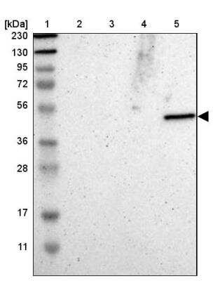 Western Blot: GALT Antibody [NBP1-86138] - Lane 1: Marker  [kDa] 230, 130, 95, 72, 56, 36, 28, 17, 11.  Lane 2: Human cell line RT-4.  Lane 3: Human cell line U-251MG sp.  Lane 4: Human plasma (IgG/HSA depleted).  Lane 5: Human liver tissue