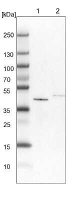 <b>Independent Antibodies Validation. </b>Western Blot: GALT Antibody [NBP1-86138] - Lane 1: NIH-3T3 cell lysate (Mouse embryonic fibroblast cells). Lane 2: NBT-II cell lysate (Rat Wistar bladder tumor cells).