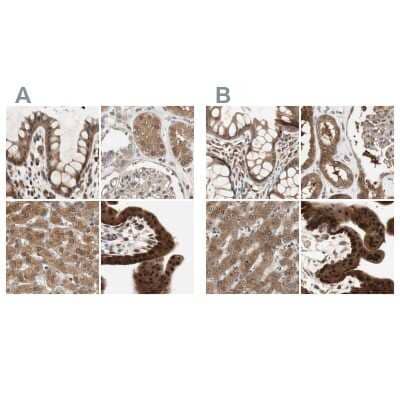 Immunohistochemistry-Paraffin: GALT Antibody [NBP1-86138] - Staining of human colon, kidney, liver and placenta using Anti-GALT antibody NBP1-86138 (A) shows similar protein distribution across tissues to independent antibody NBP1-86133 (B).