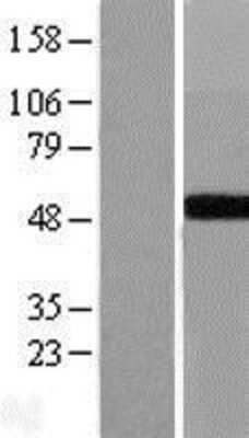 Western Blot: GALT Overexpression Lysate (Adult Normal) [NBL1-10964] Left-Empty vector transfected control cell lysate (HEK293 cell lysate); Right -Over-expression Lysate for GALT.