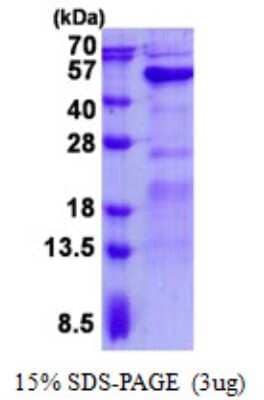 SDS-Page: GALT Protein [NBP2-23068]