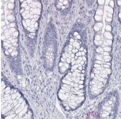 Immunohistochemistry-Paraffin: GAMT Antibody [NBP2-14036] - Staining of human rectum shows no positivity in glandular cells as expected.