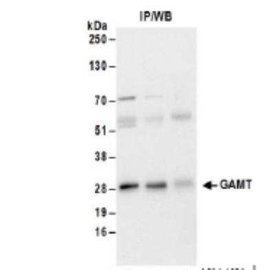 <b>Biological Strategies Validation. </b>Immunoprecipitation: GAMT Antibody [NBP2-34854] - Detection of Human GAMT by Western Blot of Immunoprecipitates. Samples: Whole cell lysate (1 mg for IP; 20% of IP loaded) from Jurkat cells.