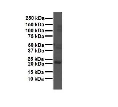 Western Blot: GAMT Antibody [NBP1-54399] - Antibody  Titration: 1 ug/ml Human liver.