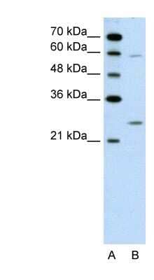 Western Blot: GAMT Antibody [NBP1-54819] - Jurkat cell lysate, concentration 0.2-1 ug/ml.