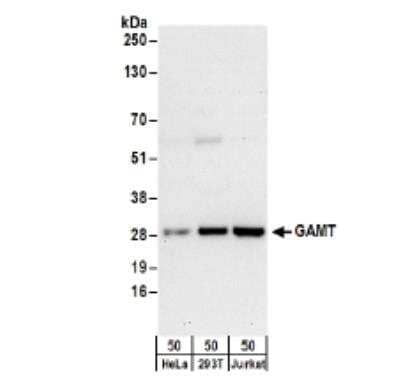 Western Blot: GAMT Antibody [NBP2-34854] - Detection of Human GAMT by Western Blot. Samples: Whole cell lysate (50 ug) from HeLa, 293T, and Jurkat cells.