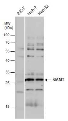 Western Blot: GAMT Antibody [NBP3-12967] - GAMT antibody detects GAMT protein by western blot analysis. Various whole cell extracts (30 ug) were separated by 12% SDS-PAGE, and the membrane was blotted with GAMT antibody (NBP3-12967) diluted at a dilution of 1:1000.