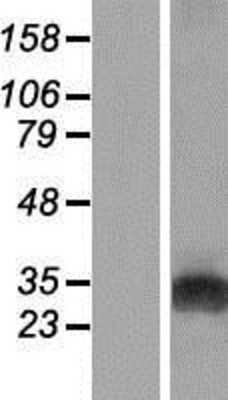 Western Blot: GAMT Overexpression Lysate (Adult Normal) [NBP2-09052] Left-Empty vector transfected control cell lysate (HEK293 cell lysate); Right -Over-expression Lysate for GAMT.