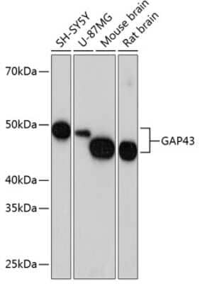 Western Blot: GAP-43 Antibody (8E7C8) [NBP3-15636] - Western blot analysis of extracts of various cell lines, using GAP-43 antibody (NBP3-15636) at 1:1000 dilution. Secondary antibody: HRP Goat Anti-Rabbit IgG (H+L) at 1:10000 dilution. Lysates/proteins: 25ug per lane. Blocking buffer: 3% nonfat dry milk in TBST. Detection: ECL Basic Kit. Exposure time: 10s.