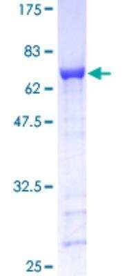 SDS-Page: GAP-43 Recombinant Protein [H00002596-P01]