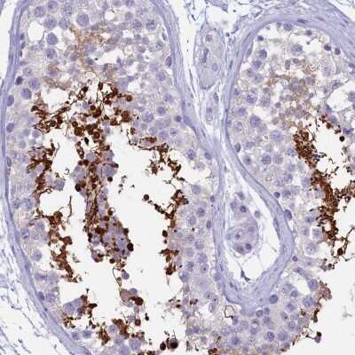 Immunohistochemistry-Paraffin: GAPDH-2 Antibody [NBP2-31925] - Staining of human testis shows high expression.