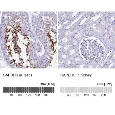 <b>Orthogonal Strategies Validation. </b>Immunohistochemistry-Paraffin: GAPDH-2 Antibody [NBP2-31925] - Staining in human testis and kidney tissues using anti-GAPDHS antibody. Corresponding GAPDHS RNA-seq data are presented for the same tissues.