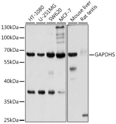 Western Blot: GAPDH-2 Antibody [NBP3-03522] - Analysis of extracts of various cell lines, using GAPDH-2 antibody at 1:1000 dilution. Secondary antibody: HRP Goat Anti-Rabbit IgG (H+L) at 1:10000 dilution. Lysates/proteins: 25ug per lane. Blocking buffer: 3% nonfat dry milk in TBST. Detection: ECL Basic Kit.