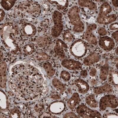 Immunohistochemistry-Paraffin: GAPDH Antibody (CL3265) [NBP2-59025] - Staining of human kidney shows strong cytoplasmic and nuclear positivity in renal tubules and glomeruli.