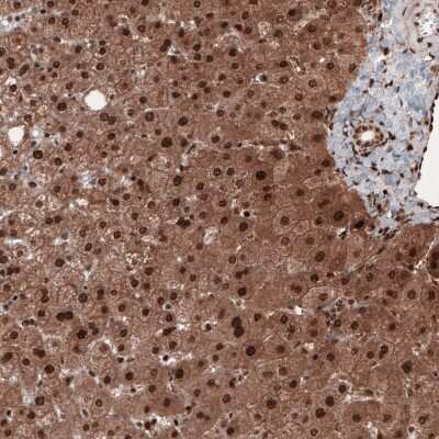 Immunohistochemistry-Paraffin: GAPDH Antibody (CL3265) [NBP2-59025] - Staining of human liver shows strong cytoplasmic and nuclear immunoreactivity in hepatocytes.