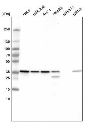 Western Blot: GAPDH Antibody (CL3265) [NBP2-59025] - Analysis in human cell line HeLa, human cell line HEK 293, human cell line A-431, human cell line HepG2, mouse cell line NIH-3T3 and rat cell line NBT-II. Theoretical molecular weight: 36 kDa.