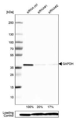 Western Blot: GAPDH Antibody (CL3265) [NBP2-59025] - Theoretical molecular weight: 36 kDa. Analysis in U-251MG cells transfected with control siRNA, target specific siRNA probe #1 and #2, using Anti-GAPDH antibody. Remaining relative intensity is presented. Loading control: Anti-PPIB.