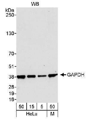 Western Blot: GAPDH Antibody [NB300-324] - Detection of Human and Mouse GAPDH, theoretical molecular weight 36 kDa. Whole cell lysate from HeLa (5, 15 and 50 mcg) and mouse NIH3T3 (M; 50 mcg). Affinity purified rabbit anti-GAPDH antibody used at 0.04 mcg/ml. Chemiluminescence with an exposure time of 10 seconds.