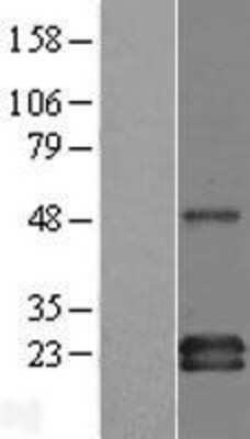 Western Blot: GAPT Overexpression Lysate (Adult Normal) [NBL1-08489] Left-Empty vector transfected control cell lysate (HEK293 cell lysate); Right -Over-expression Lysate for GAPT.