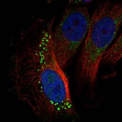 Immunocytochemistry/Immunofluorescence: GARNL3 Antibody [NBP1-90799] - Immunofluorescent staining of human cell line U-251 MG shows localization to vesicles.