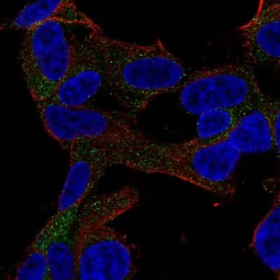 Immunocytochemistry/ Immunofluorescence GARNL3 Antibody - BSA Free