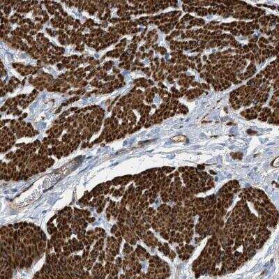 Immunohistochemistry: GARNL3 Antibody [NBP1-90800] - Immunohistochemical staining of human smooth muscle shows cytoplasmic positivity in smooth muscle cells.