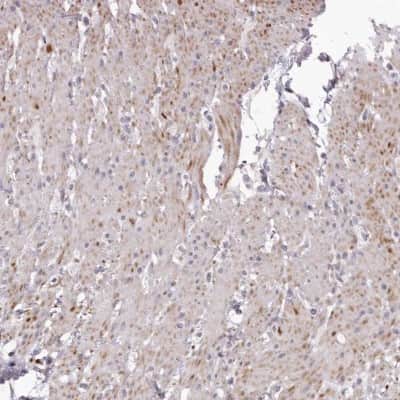 Immunohistochemistry-Paraffin: GARNL3 Antibody [NBP1-90799] - Staining of human smooth muscle shows cytoplasmic positivity in smooth muscle cells.