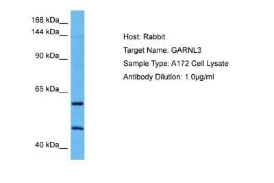 Western Blot: GARNL3 Antibody [NBP2-87364] - Host: Rabbit. Target Name: GARNL3. Sample Tissue: Human A172 Whole Cell lysates. Antibody Dilution: 1ug/ml
