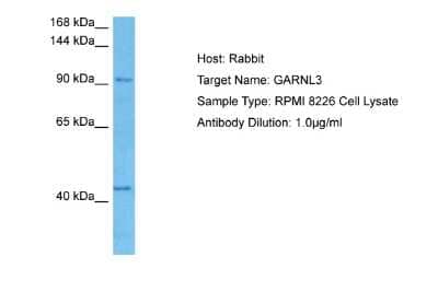 Western Blot: GARNL3 Antibody [NBP2-87488] - Host: Rabbit. Target Name: GARNL3. Sample Tissue: Human RPMI 8226 Whole Cell lysates. Antibody Dilution: 1ug/ml