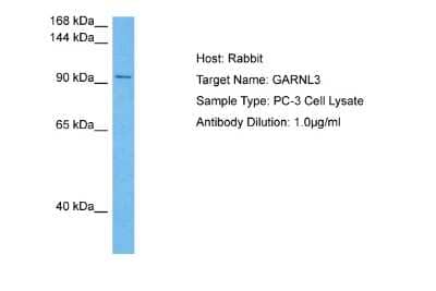 Western Blot: GARNL3 Antibody [NBP2-87489] - Host: Rabbit. Target Name: GARNL3. Sample Tissue: Human PC-3 Whole Cell lysates. Antibody Dilution: 1ug/ml