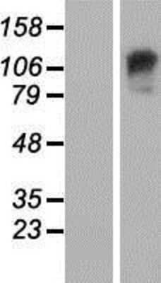 Western Blot GARNL3 Overexpression Lysate