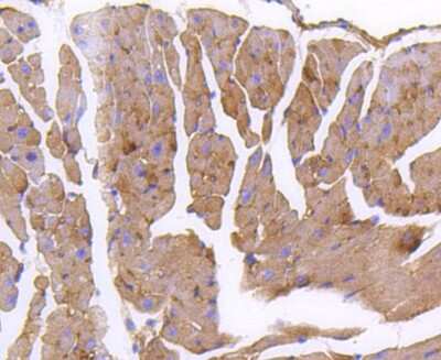 Immunohistochemistry-Paraffin: GARS Antibody (SC0651) [NBP2-67611] - Analysis of paraffin-embedded mouse heart tissue using anti-GARS antibody. Counter stained with hematoxylin.