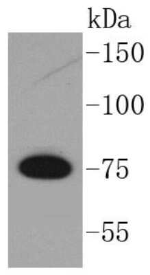 Western Blot: GARS Antibody (SC0651) [NBP2-67611] - Analysis of GARS on Raji cells lysates using anti-GARS antibody at 1/1,000 dilution.