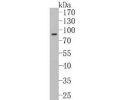 Western Blot: GARS Antibody (SC0651) [NBP2-67611] - Western blot analysis of GARS on Raji cells lysates using anti-GARS antibody at 1/1,000 dilution.