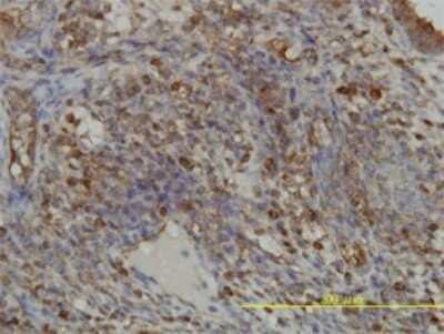 Immunohistochemistry-Paraffin: GART Antibody (4D6-1D5) [H00002618-M01] - Analysis of monoclonal antibody to GART on formalin-fixed paraffin-embedded human endometrium tissue. Antibody concentration 2 ug/ml.