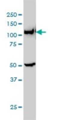 Western Blot: GART Antibody (4D6-1D5) [H00002618-M01] - GART monoclonal antibody (M01), clone 4D6-1D5 Analysis of GART expression in Hela S3 NE.