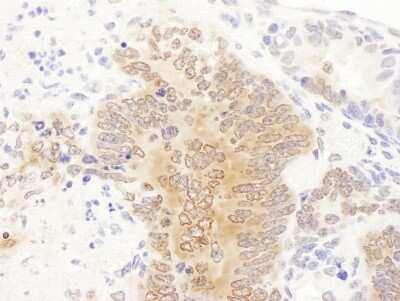 <b>Biological Strategies Validation. </b>Immunohistochemistry: GART Antibody [NBP2-32206] - Sample: FFPE section of mouse teratoma. Antibody: Affinity purified rabbit anti-GART used at a dilution of 1:1,000 (1ug/ml). Detection: DAB. Counterstain: IHC Hematoxylin (blue).