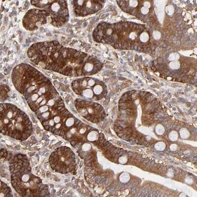 Immunohistochemistry-Paraffin: GART Antibody [NBP1-87290] - Staining of human duodenum shows strong cytoplasmic positivity in glandular cells.