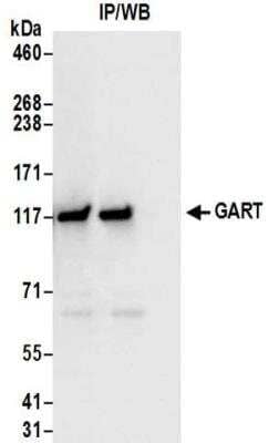 Immunoprecipitation: GART Antibody [NBP2-32206] - Samples:  Whole cell lysate (0.5 or 1.0 mg per IP reaction; 20% of IP loaded) from 293T cells. Antibodies:  Affinity purified rabbit anti-GART antibody NBP2-32206 used for IP at 6 ug per reaction. For blotting immunoprecipitated GART was used at 1 ug/ml.  Detection: Chemiluminescence with an exposure time of 3 seconds.