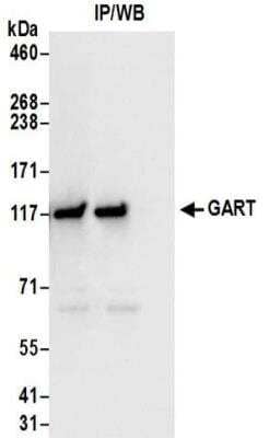 Immunoprecipitation: GART Antibody [NBP2-32207] - Samples:  Whole cell lysate (0.5 or 1.0 mg per IP reaction; 20% of IP loaded) from 293T cells. Antibodies:  Affinity purified rabbit anti-GART antibody NBP2-32207 used for IP at 6 ug per reaction. For blotting immunoprecipitated GART, NBP2-32207 was used at 1 ug/ml.  Detection: Chemiluminescence with an exposure time of 3 seconds.