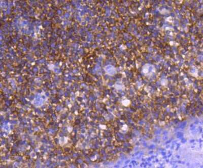 Immunohistochemistry-Paraffin: GART Antibody (SC66-02) [NBP2-67612] - Analysis of paraffin-embedded human tonsil tissue using anti-GART antibody. Counter stained with hematoxylin.