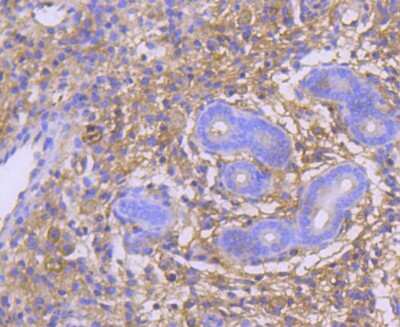 Immunohistochemistry-Paraffin: GART Antibody (SC66-02) [NBP2-67612] - Analysis of paraffin-embedded mouse uterus tissue using anti-GART antibody. Counter stained with hematoxylin.