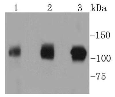 Western Blot: GART Antibody (SC66-02) [NBP2-67612] - Analysis of GART on different lysates using anti-GART antibody at 1/1,000 dilution. Positive control: Lane 1: Hela Lane 2: 293T Lane 3: A431