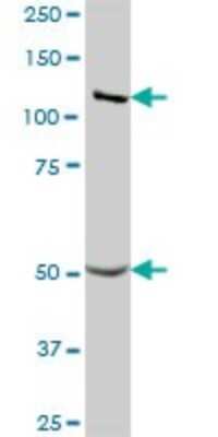 Western Blot: GART Antibody [H00002618-B01P] - Analysis of GART expression in human liver.