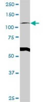Western Blot: GART Antibody [H00002618-D01P] - Analysis of GART expression in human placenta.