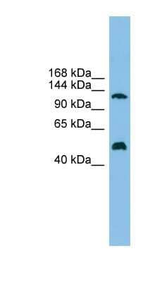 Western Blot: GART Antibody [NBP1-57774] - 721_B cell lysate, concentration 0.2-1 ug/ml.